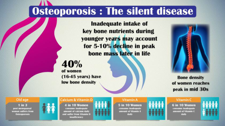 Osteoporosis In Young Women The Abcs Of Prevention Dr Arnab Karmakar