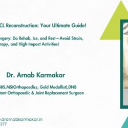 ACL surgeon in Kolkata